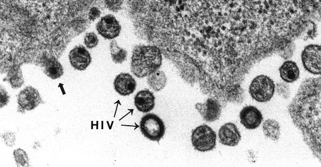 Retrovirus y virus reconducidos