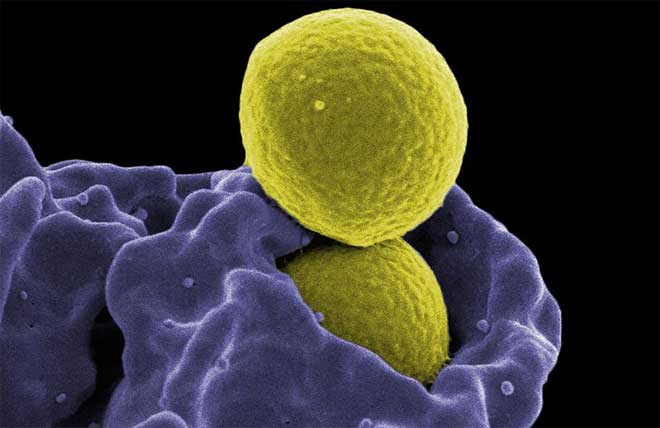 Sistema inmune atrapando bacteria extraña