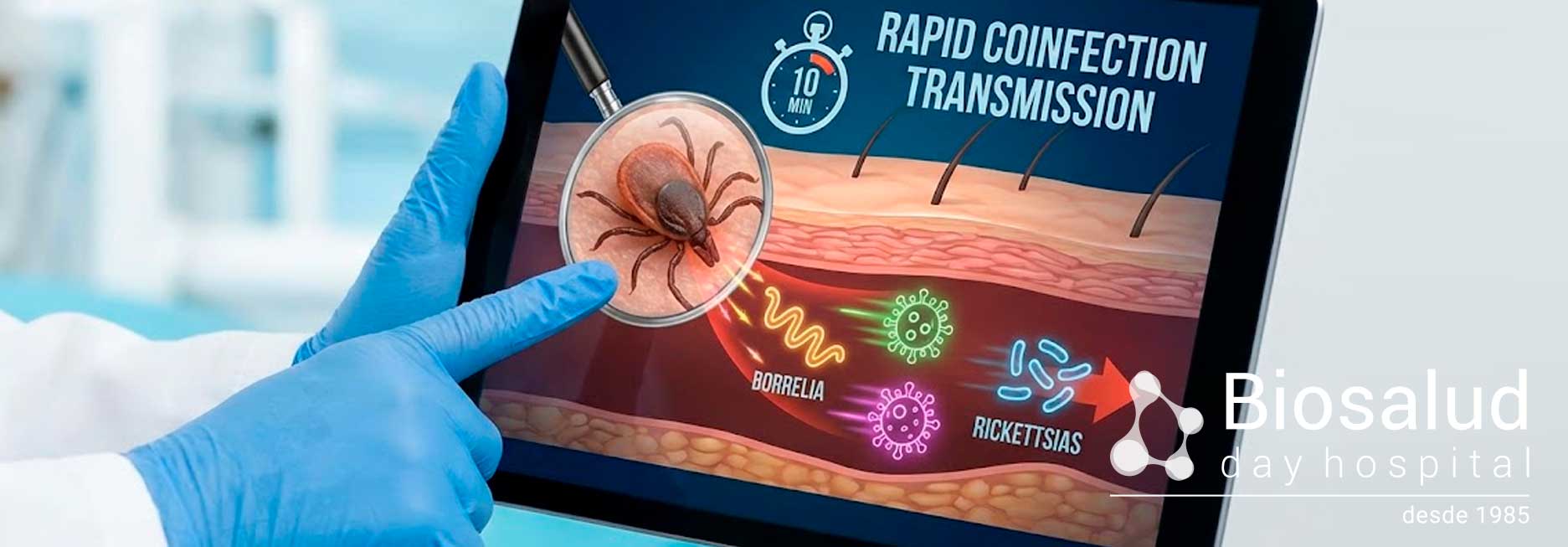 Datos sobre el contagio y prevención del Lyme que no sabías