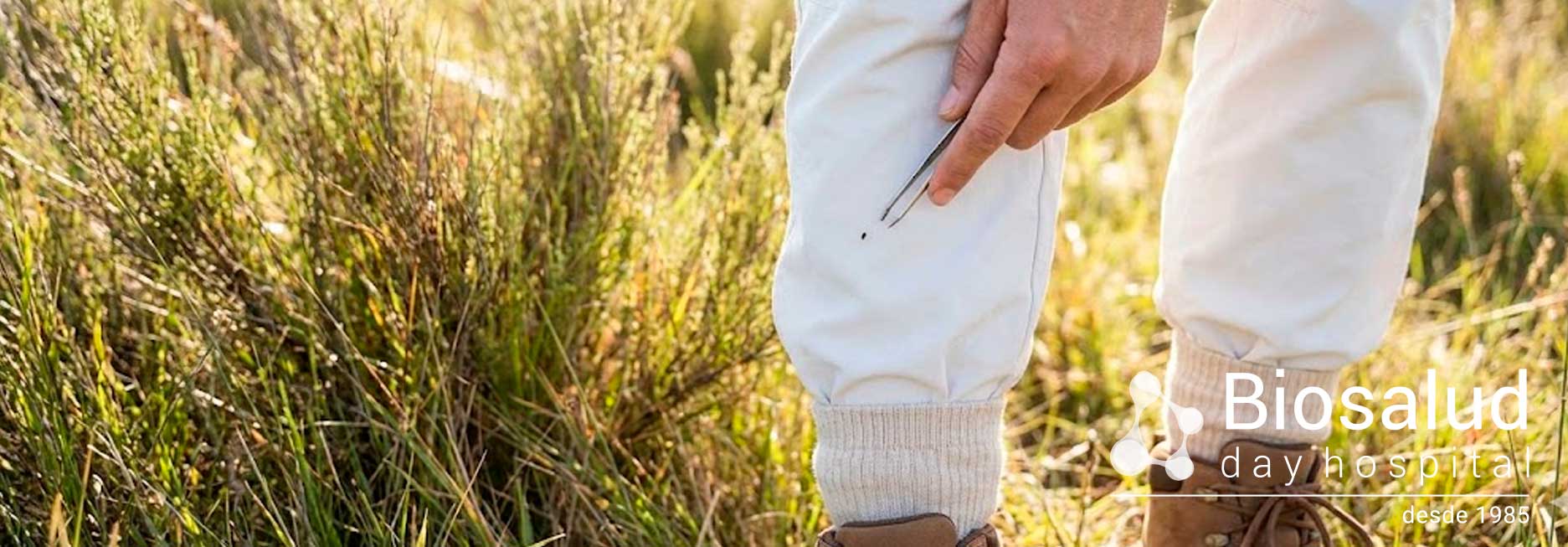 La ropa clara no es moda, es supervivencia contra las garrapatas La ropa clara no es moda, es supervivencia contra las garrapatas