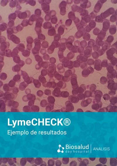 Ejemplo de resultados del Análisis de la Enfermedad de Lyme LymeCHECK®