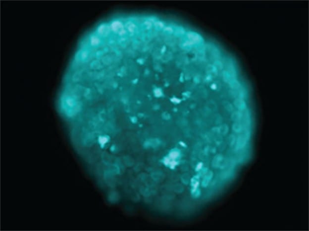 Medicina Biologica Biosalud nanoparticulas portadoras de farmacos para tumores 624x468 1