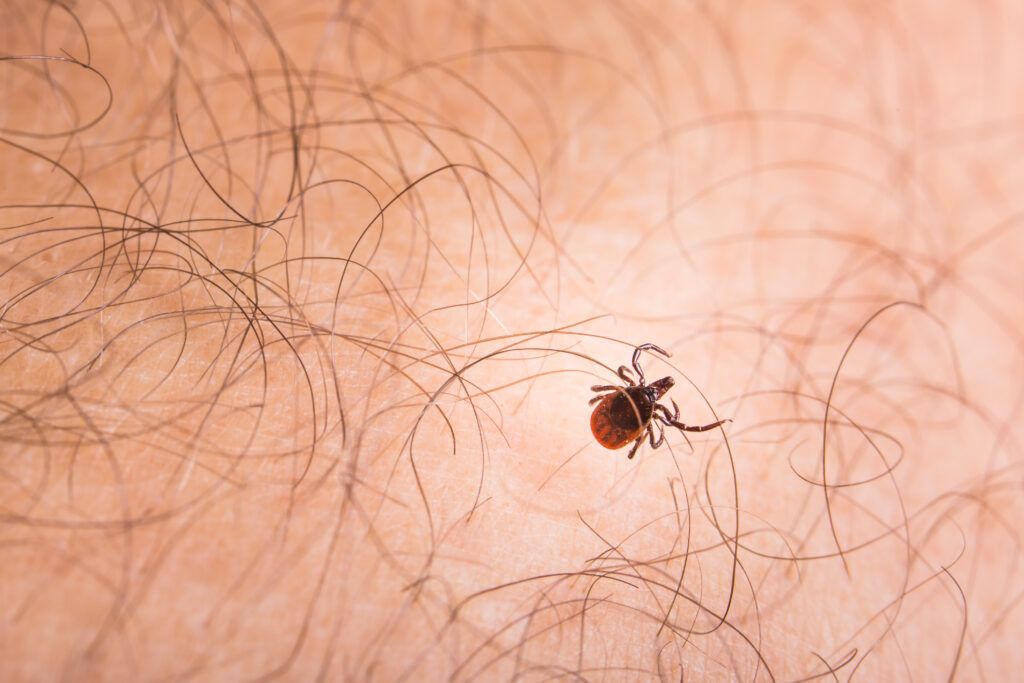 Medicina Biologica Biosalud tick parasitic arachnid blood sucking carrier of 2021 09 01 00 24 40 utc