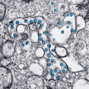 Análisis Epigenético (Riesgo precoz Deterioro Cognitivo)