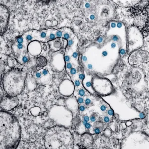 Análisis Epigenético (Riesgo precoz Deterioro Cognitivo)