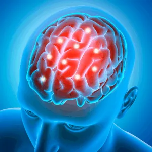 Cerebrovascular Risk (Ictus/Enfermedad Cerebrovascular)
