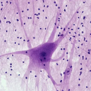 Analisis-Genetico-ParkinsonGEN-en-Saliva