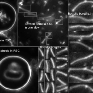 Analisis-LymeCheck-Artificial-Intelligence-para-el-diagnostico-de-la-Enfermedad-de-Lyme-biosalud