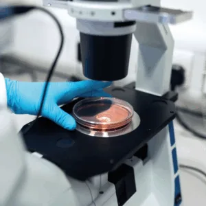 IgG A200 (Intolerancias Alimentarias por IgG)