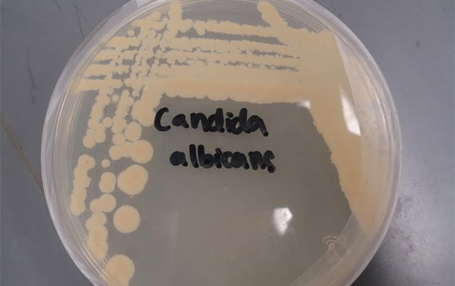 candida albicans hongo