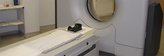Estenosis lumbar tomografía