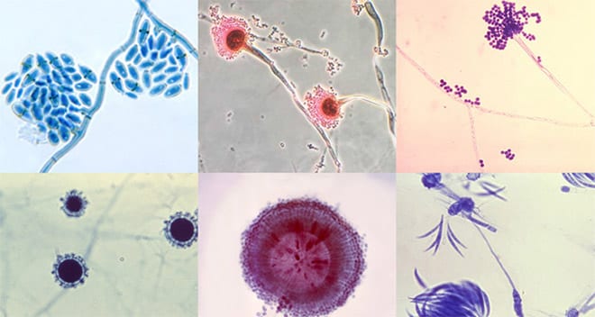 La Candida Y Otros Hongos Y Su Relación Con El Cuerpo Humano