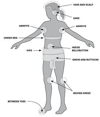 zonas do corpo com carraças